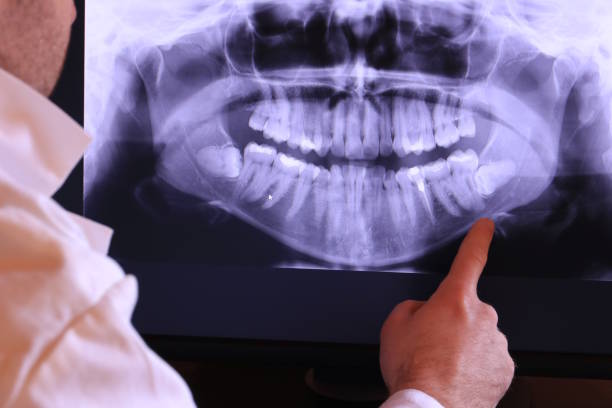 Best Emergency Treatment for Dental Infections or Abscesses in Stewartstown, PA